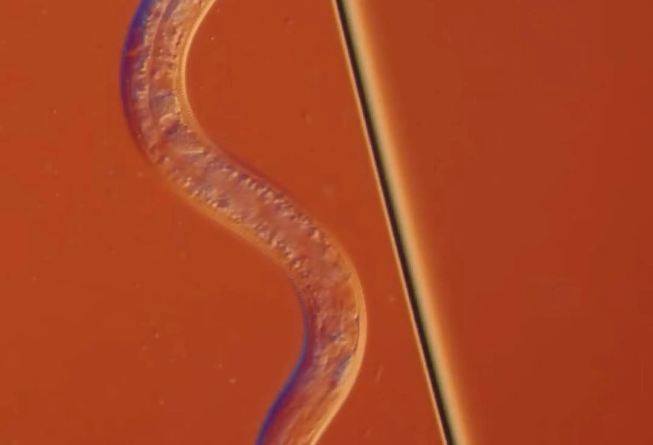 依龙卫生院粪圆线虫病专家