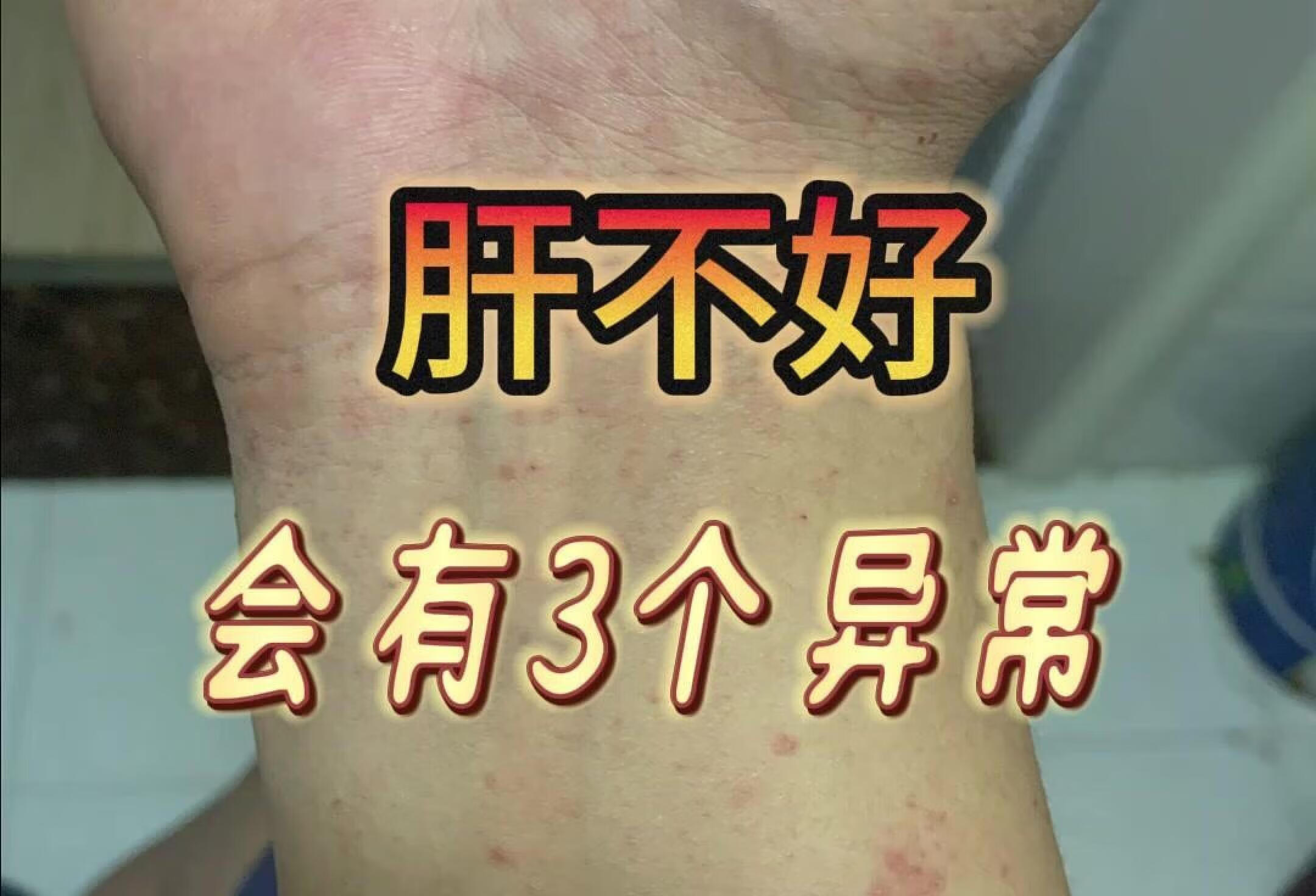包含友誼醫(yī)院先生醫(yī)生問診黃牛號販子代掛的詞條