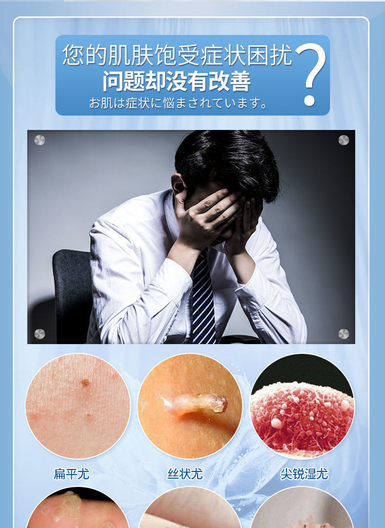 【在范】去瘊l子肉粒疙瘩去除脖子小肉l粒去角质扁平尤小猴子液温和不