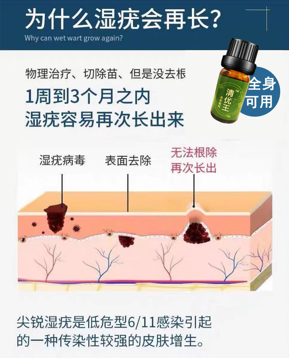 【24小時發貨】尖銳溼疣扁平疣絲狀疣尋常疣口腔疣可用非派特靈鬼臼克