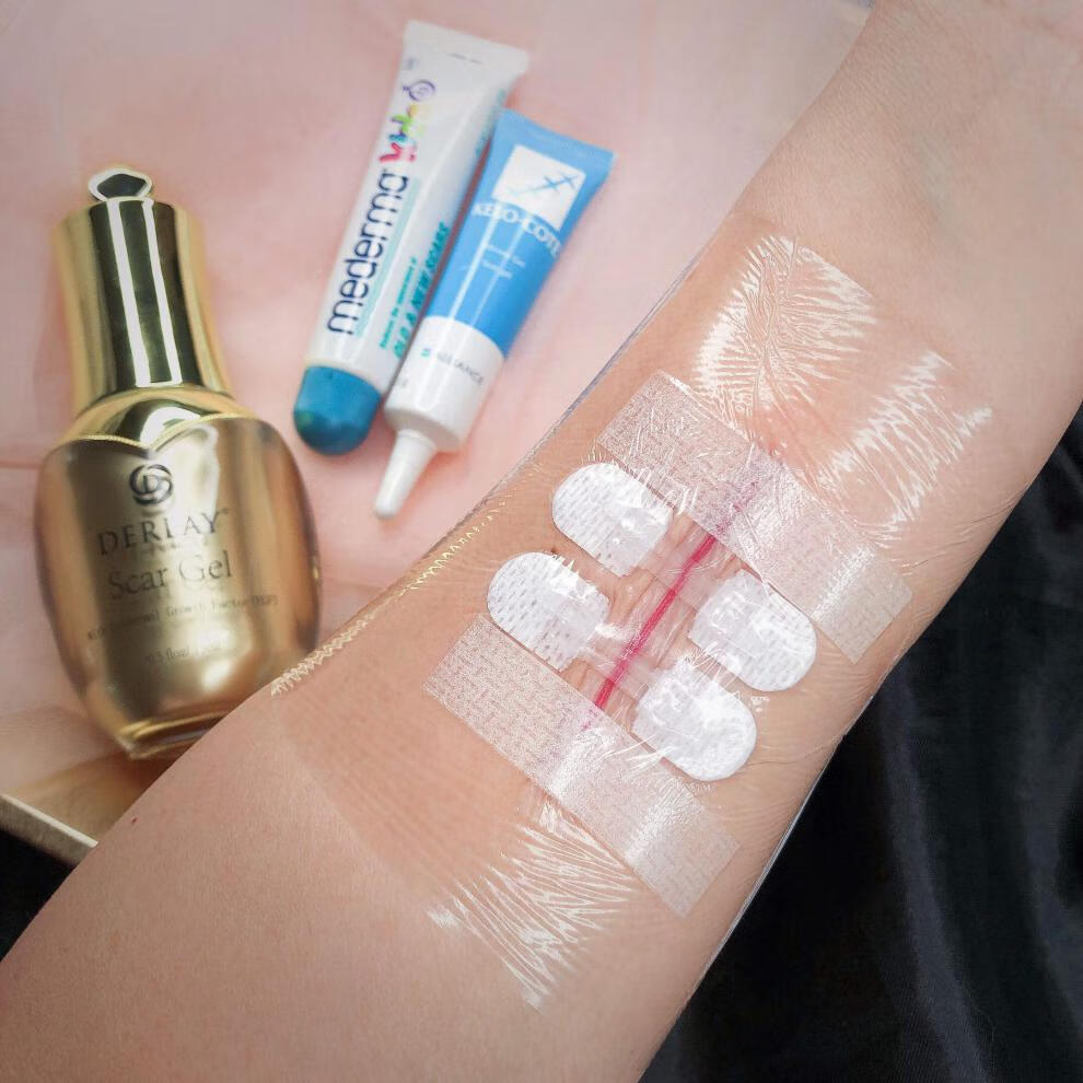 ja减张器减张贴疤痕皮肤减张贴儿童拉链创可贴zip剖腹产免缝胶带大号