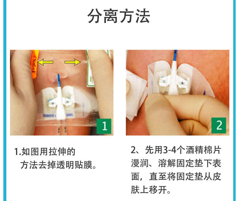 妥能蝴蝶型体表导管固定装置思乐扣picc导管固定器胆汁引流固定贴 思