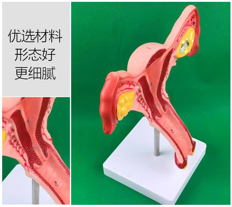 人体子宫模型教具模具卵巢解剖病理医学女性仿真女性生殖模器d卵巢yn
