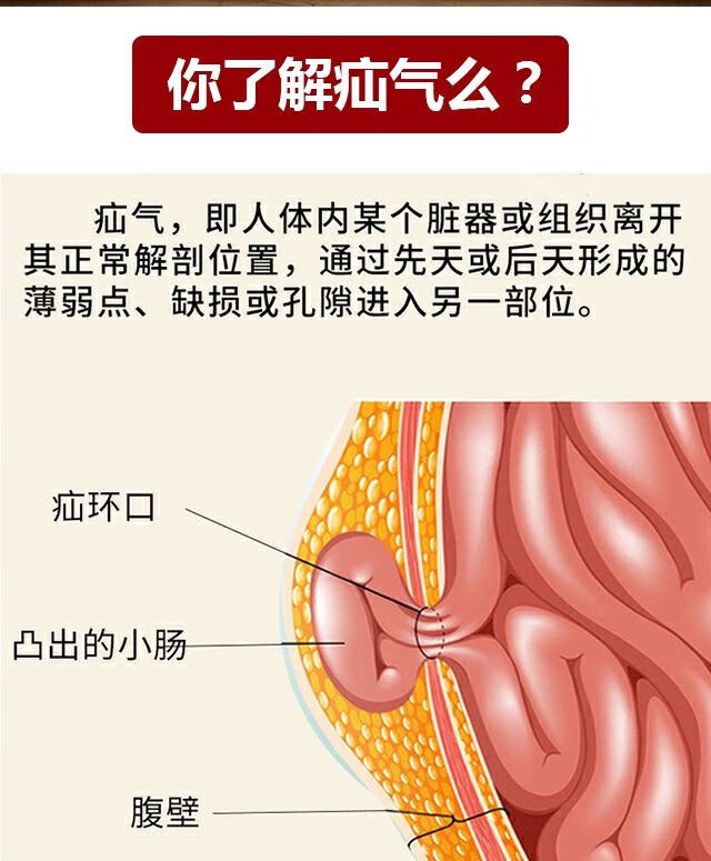 臍疝貼疝氣貼嬰兒凸肚臍中老年老人腹股溝帶兜男性肚臍冷敷貼臍疝貼