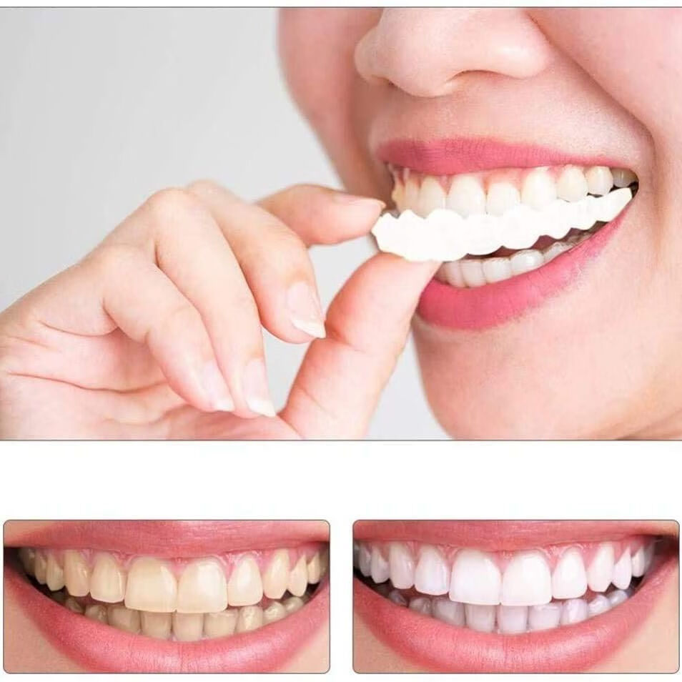 药房直售 39代仿真塑形牙套老人吃饭通用临时固假牙缺牙填充牙缝补l牙