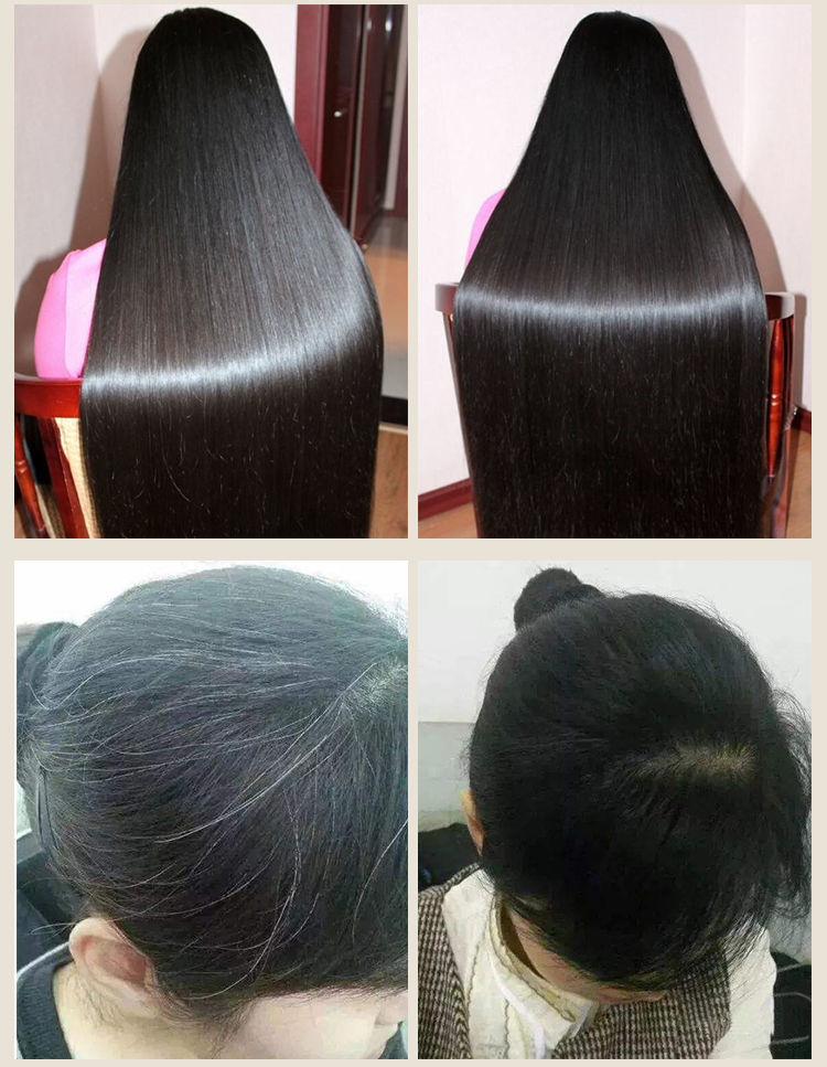 蔻月何首乌白头l发转黑发中老年产l后白发乌发植物滋养护发精华乳 100