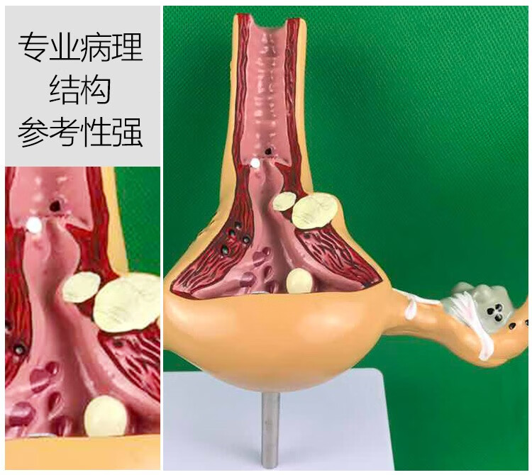 人体子宫模型教具模具卵巢解剖病理医学女性仿真女性生殖模器b款双侧