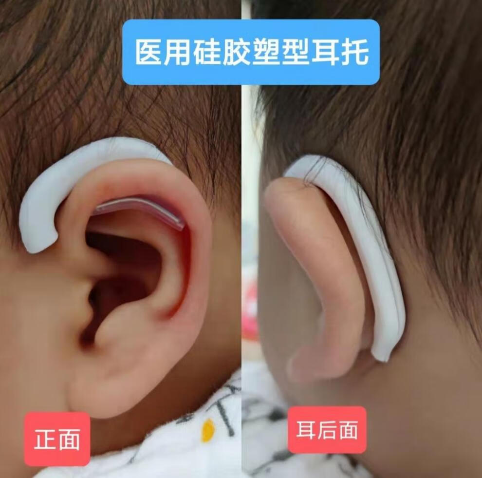 耳朵器贴面耳纠正器婴儿宝宝新生儿畸形招风耳硅胶柔软耳廓贴s22100cm