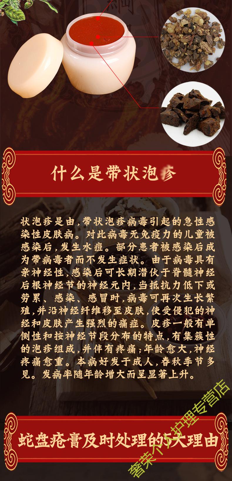 官方旗舰蛇盘创膏带状疱zen缠腰龙蛇缠腰蜘蛛疮蛇串火蛇