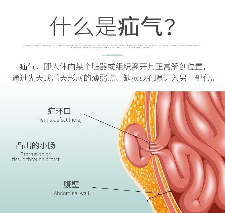 硬币脐疝带图片图片