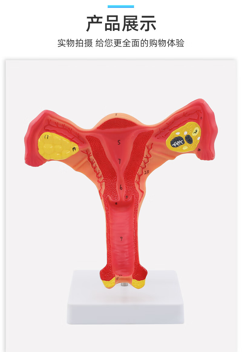 攸竹人体女性生殖子宫解剖病理模型卵巢教学模型 妇科生殖科教具 精品
