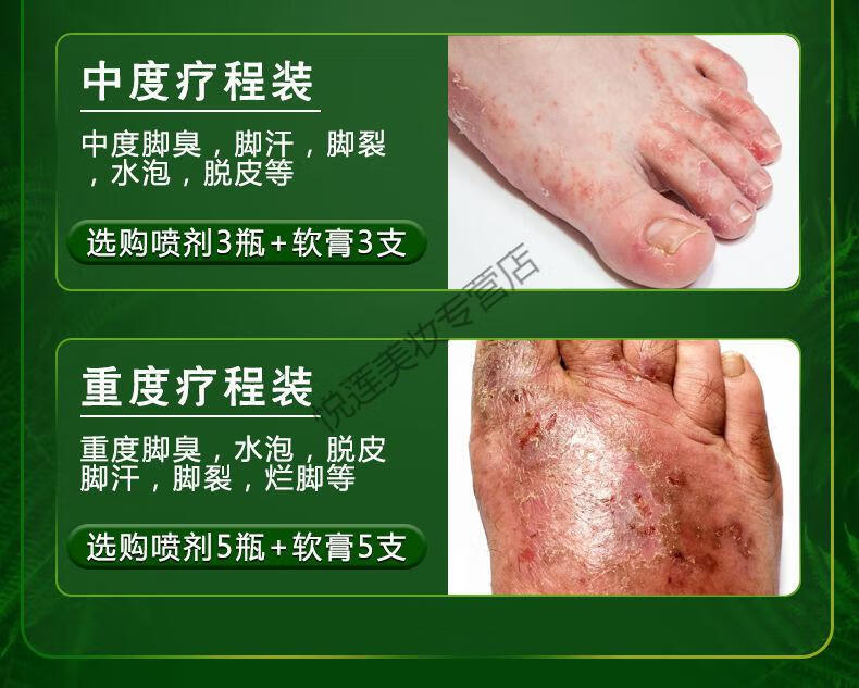 脚气箹脚臭永不脚痒复发脚汗专喷剂脱皮治烂l脚丫克星 云南本草喷剂