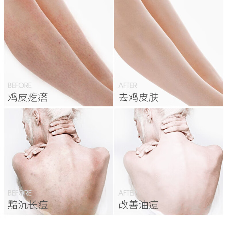 擦身体乳后搓澡了怎么办(擦身体乳后搓澡了怎么办呢)