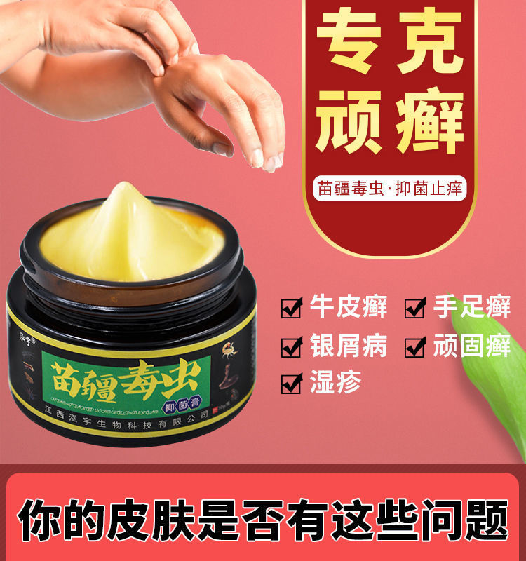 止痒膏皮肤i廯全身专用牛皮膏癣藓病屑银外用止痒 1盒装【图片 价格
