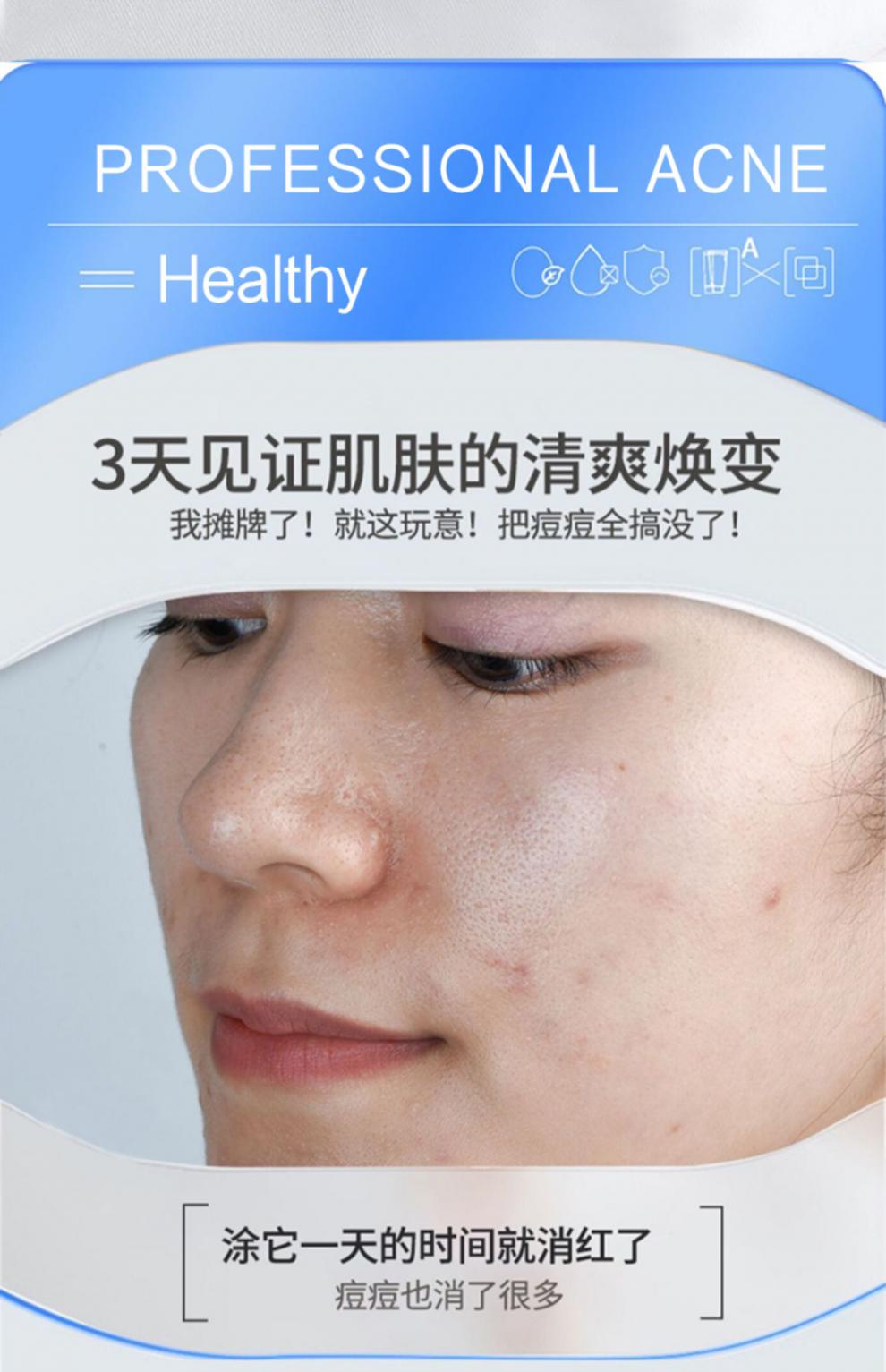 花恩施祛痘膏净颜祛痘膏去痘红肿闭口粉刺淡化祛青春痘印痘坑逗疤修复