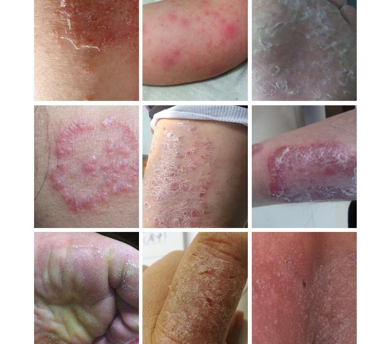 仁藏药五毒筋骨伤痛膏腰椎颈椎膝盖关节外用乳膏藏药五毒藏药癣毒王jh