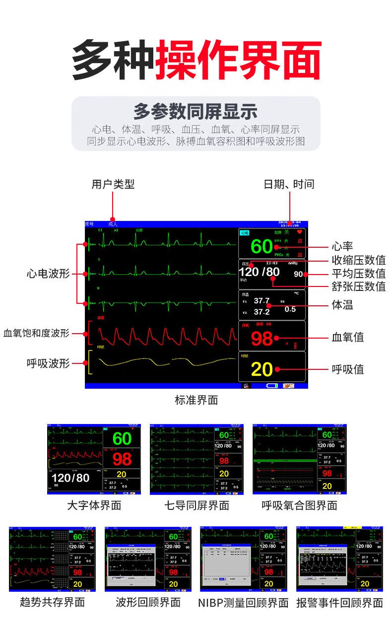 医院心电监护仪怎么看图片