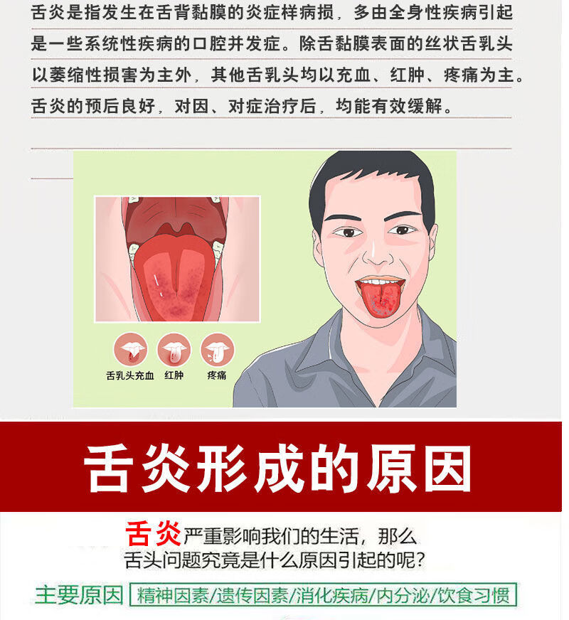 48种顽固苔癣起泡烂嘴疮扁平裂纹舌舌炎地图舌烂舌头黑舌头肿胀草莓舌