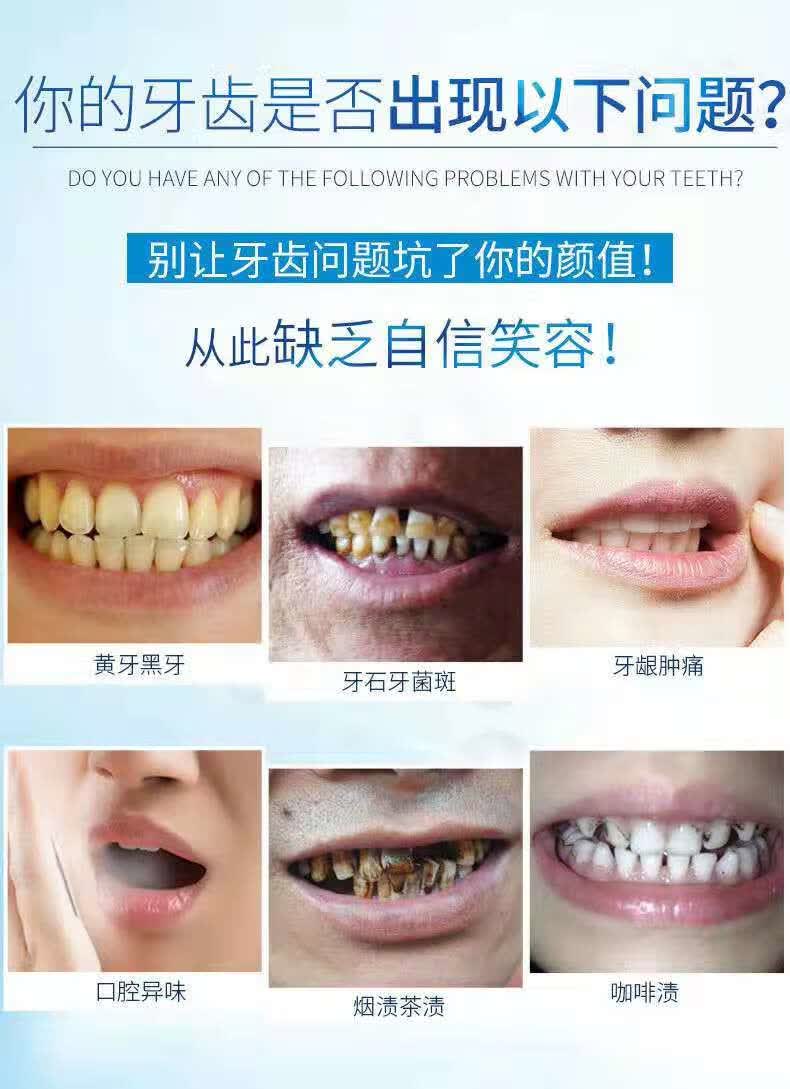 小苏打去牙1结石洗牙粉珍珠去黄洗白速1效去烟渍牙渍牙黄美白神器