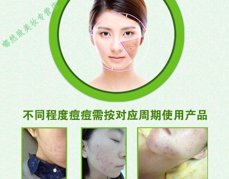吉莎肤宝吉莎痘无痕霜女士男士祛痘膏痘印痘坑痘疤痘痘青春痘粉刺