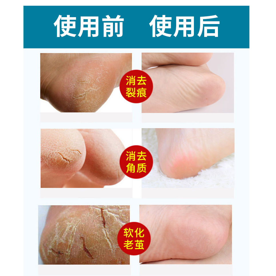 脚套足裂26只硅胶脚后跟保护套开裂防裂袜开裂套保湿润肤男女足套6只
