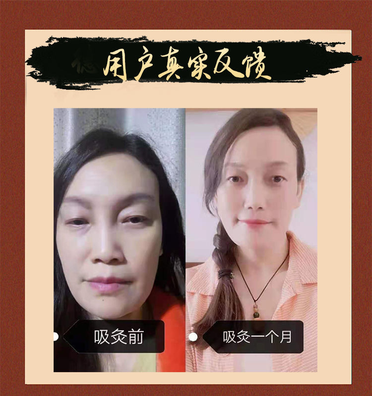 百草香灸李大为古彝百草香灸提l高l免l疫l力养生艾灸排l湿l排l寒散装