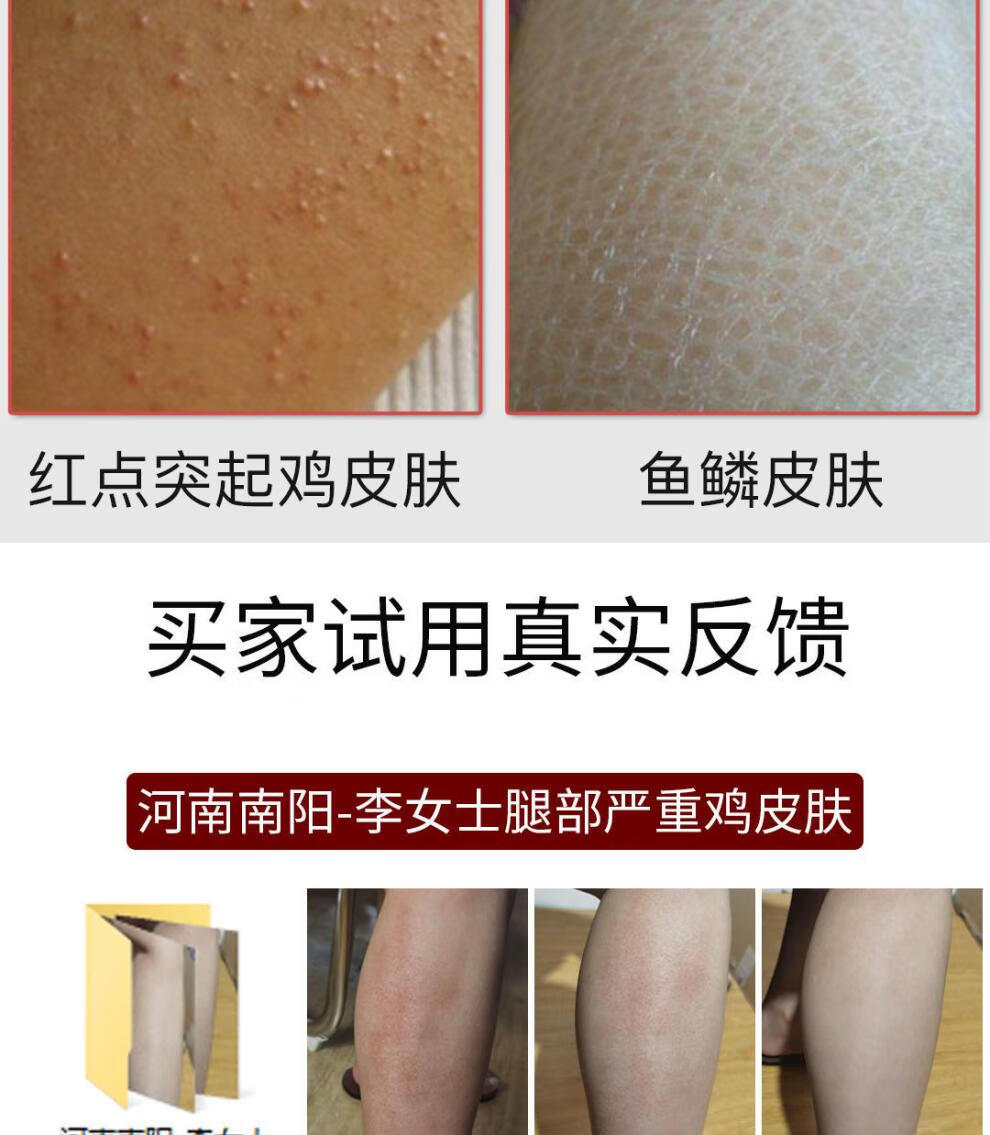 吸完奶浑身起鸡皮疙瘩(吸完奶浑身起鸡皮疙瘩怎么回事)