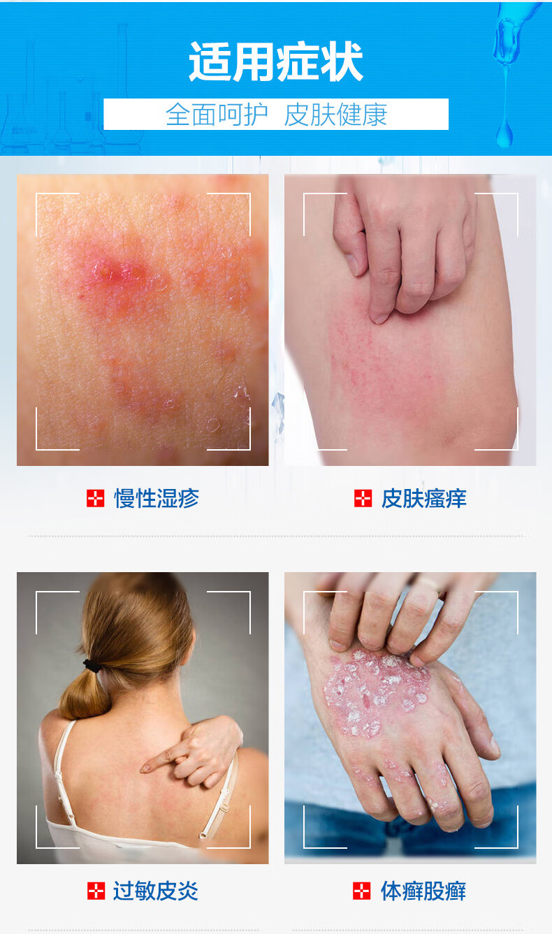迪肤康皮肤瘙痒外用乳膏止痒外用胯下大腿内侧瘙痒皮肤膏
