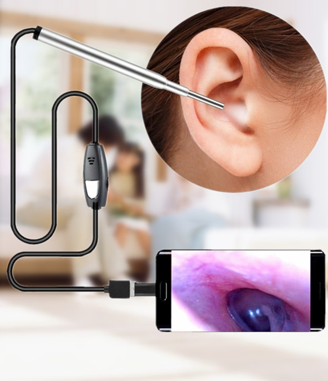 可视采耳仪器 高清检耳镜耳道内窥镜掏耳勺可视采耳仪器掏耳朵神器