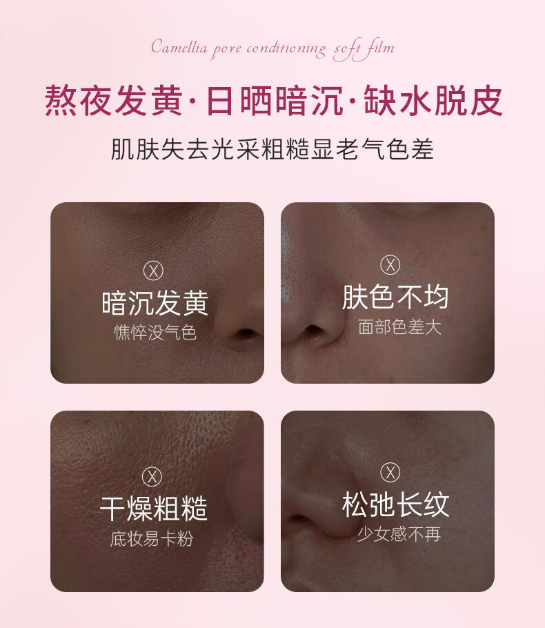 造物者山茶花清洁软膜毛孔调理软膜粉清洁软膜涂抹面膜泥膜补水保湿旗舰 升级款蝶恋肌山茶花面膜*1