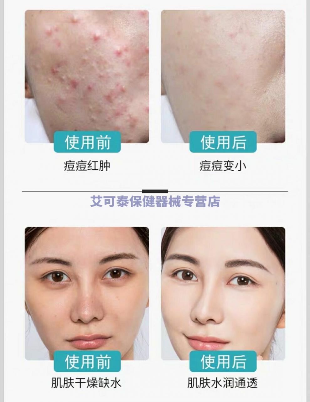 巴东讯医用冷敷贴面膜补水保湿美白学生女祛痘祛红血丝修复敏感肌升级