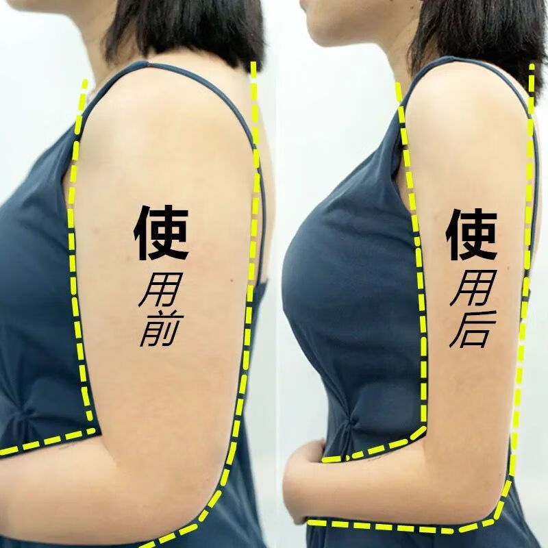 美臂 减蝴蝶臂 去掉拜拜肉 (一疗程)【图片 价格 品牌 报价】-京东