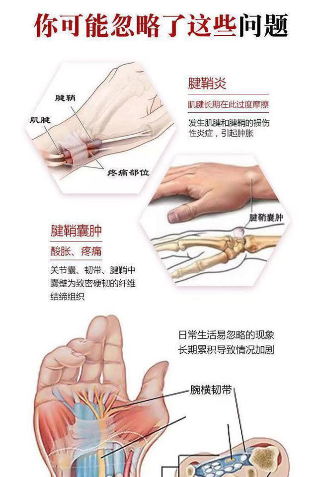 手腕痛是怎么回事图片