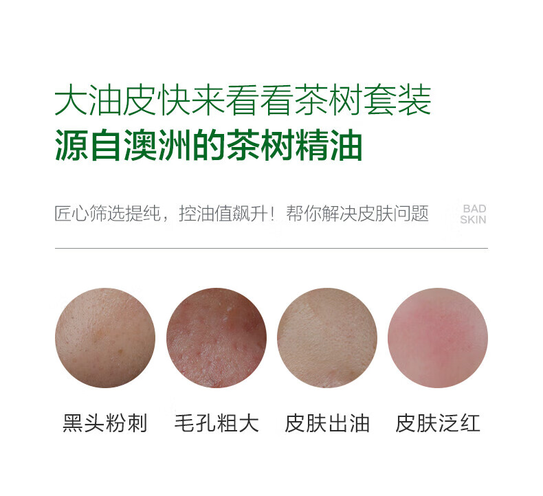小迷糊透控油茶树水乳套装礼盒 清洁控油补水保湿清爽不粘腻 [补水保湿] 清洁控油茶树3件套