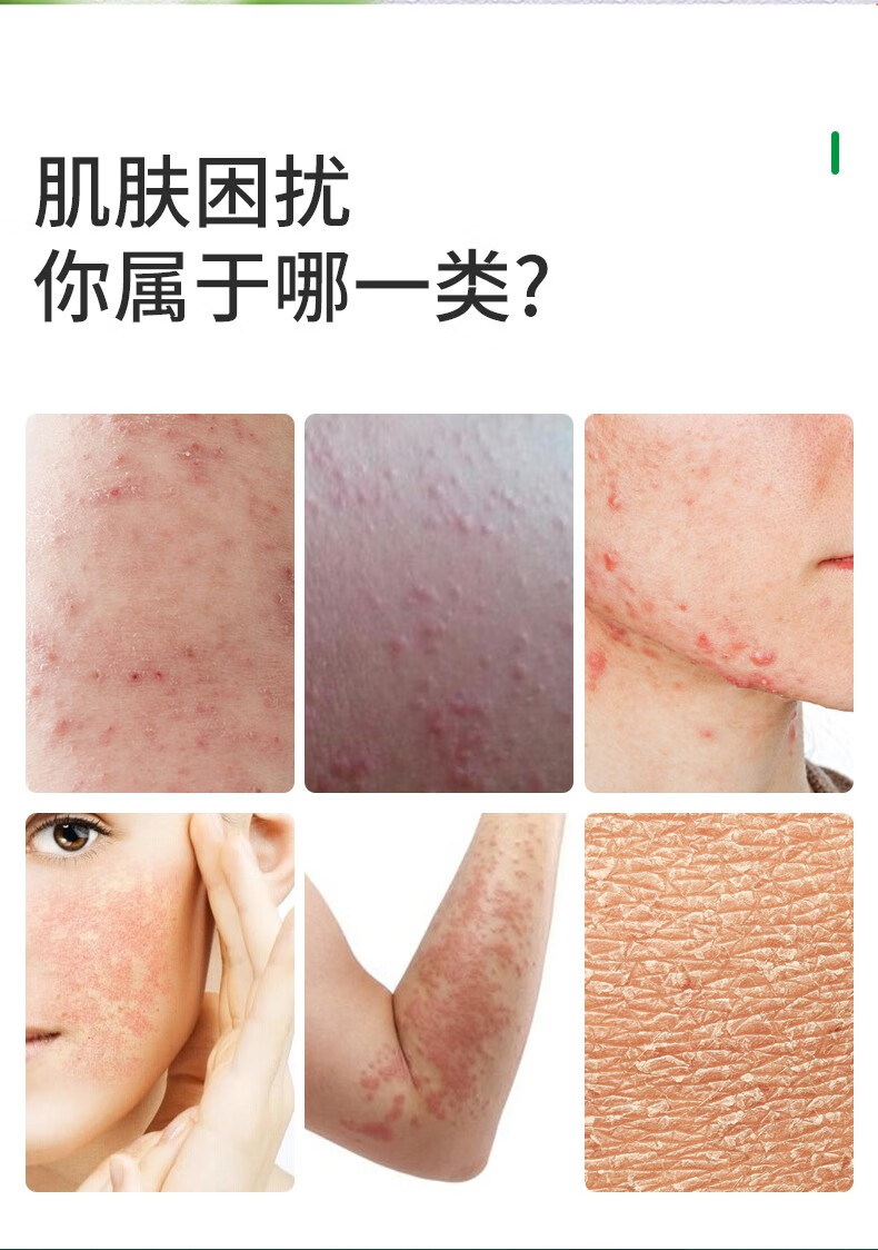 沐妍妥 液体敷料清洗型120m 创面清洗保护 浅表性创面皮肤伤口保护膜