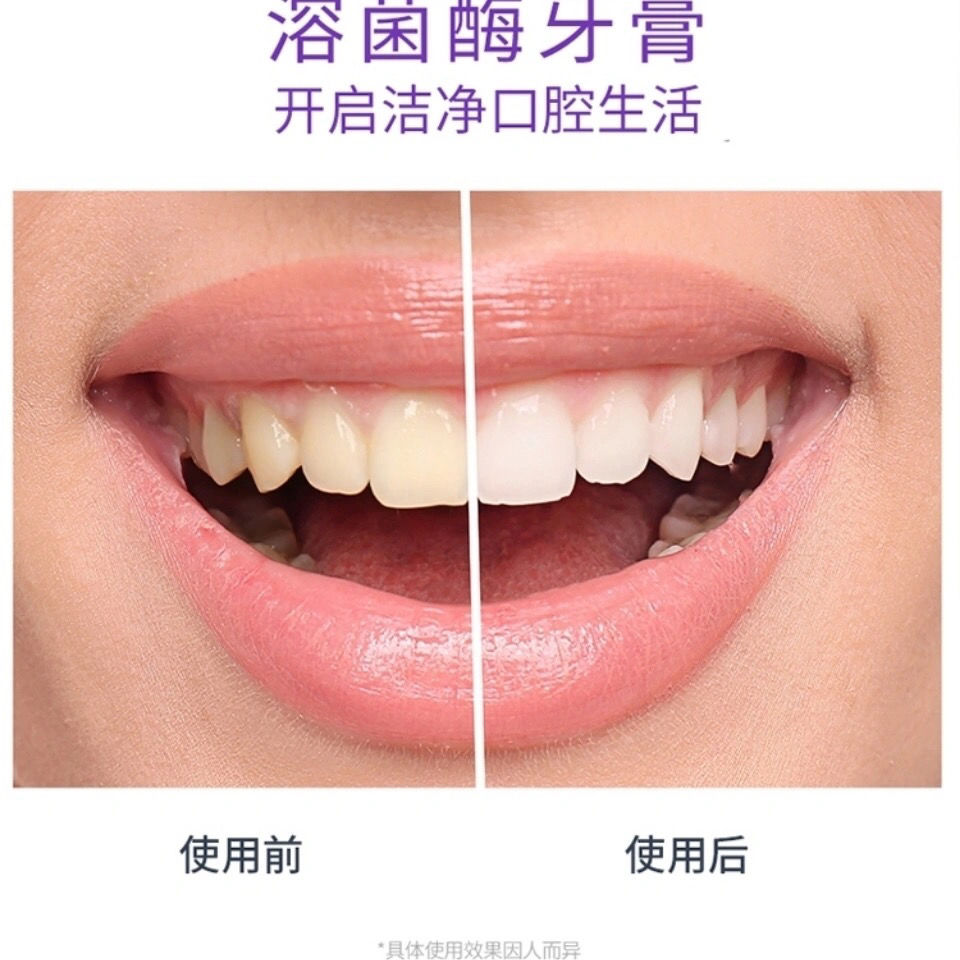 韩熙牙膏网红海莉韩熙品牌东方白芨净齿牙膏一支可用120g支