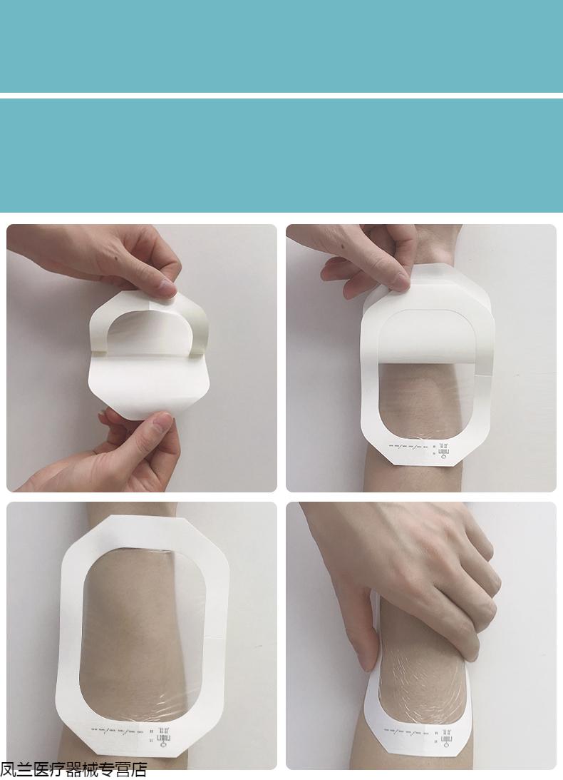 妥能医用透明敷料贴防水贴picc静脉导管固定置管敷贴膜输液滞留针贴片