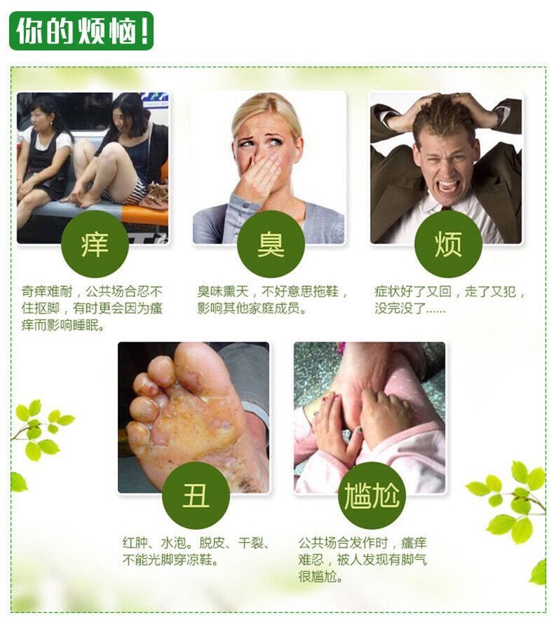 脚气喷剂 脚气喷剂单盒装【轻度适用】【图片 价格 品牌 报价】-京东