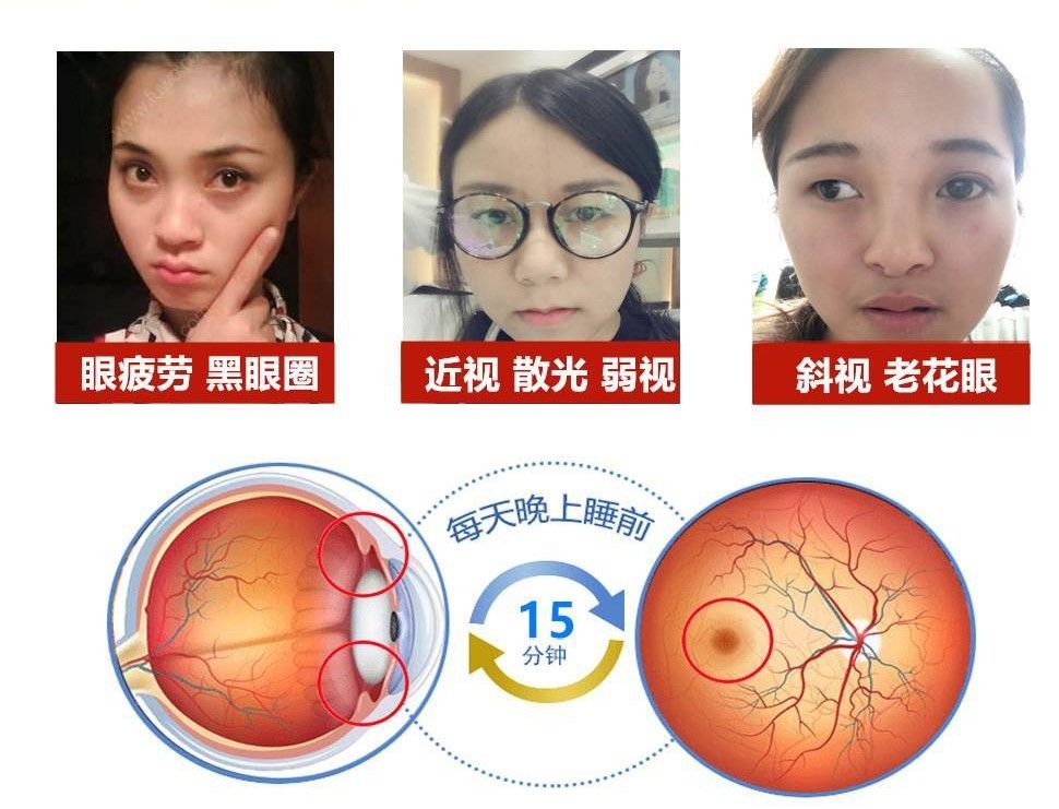 贝茨护眼仪治弱视按摩器学生视力训练仪缓解眼睛疲劳【图片 价格