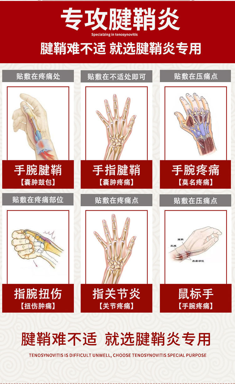 手指疼痛囊肿鼓包手腕手指麻木疼痛专用舒筋贴膏 1盒r