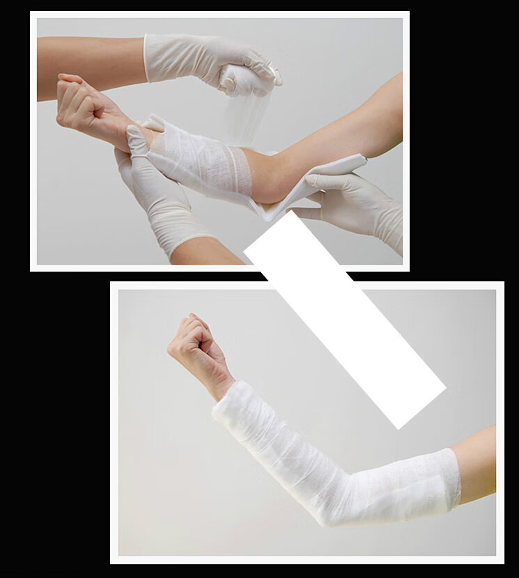 医高分子夹板石膏固定夹板急救石膏绷带医用护具脚踝腿部绑带 高分子