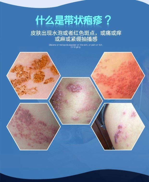 美度加l丹三号状肤宁套装壮肤宁喷雾软状膏套装浅灰色