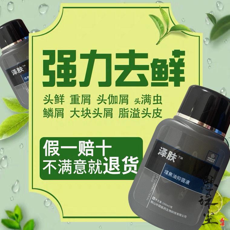 1%煤焦油洗剂 择他煤焦油液泽他泽它洗剂头痒大块头皮屑脂溢性头皮