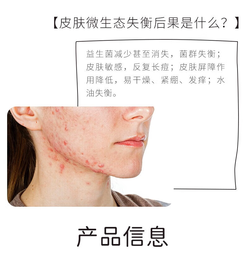 滋予儿童洗面奶12-18岁青春期女孩护肤品套装氨基酸控油抑痘洁面 滋予芭比水感素净洁面乳 默认1