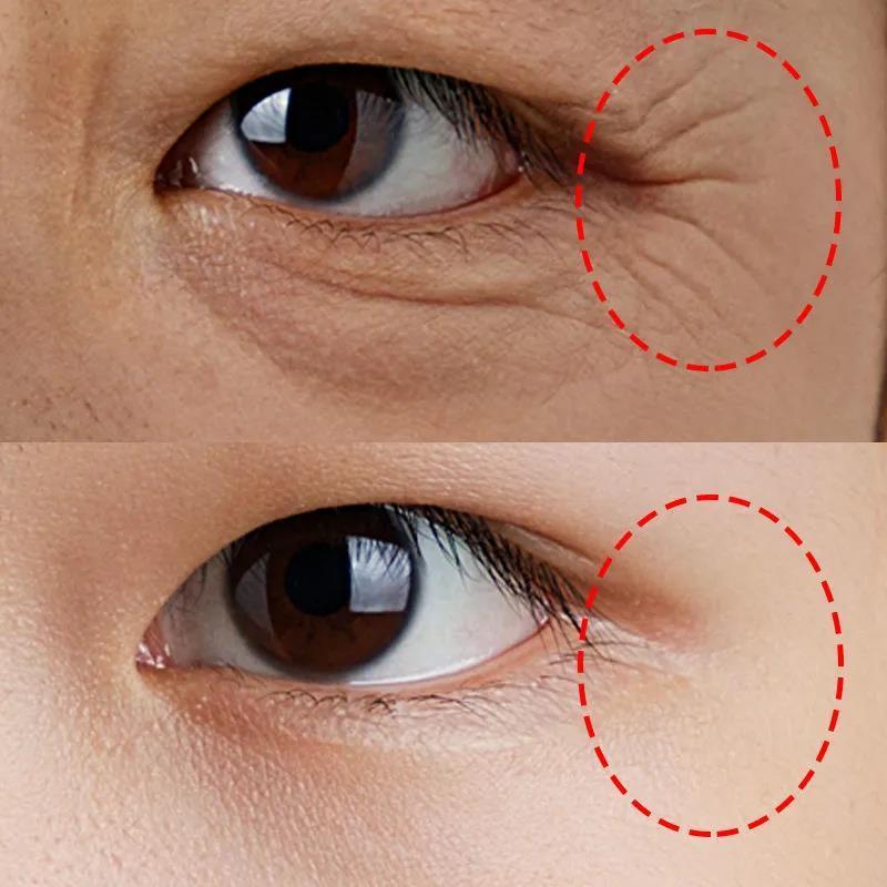 眼霜去黑眼圈纹眼圈去眼角纹补水男女效果翻倍眼霜精华液