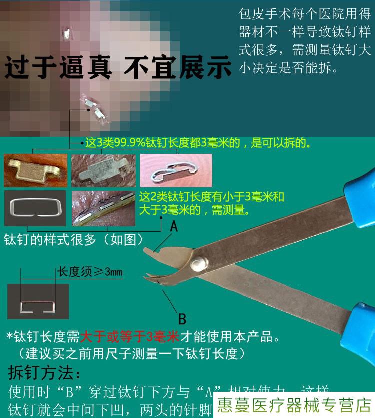 环切钛钉脱落示意图图片