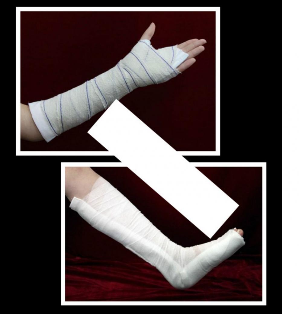 固定夹板急救石膏绷带护具脚踝腿部绑带 高分子石膏绷带15*360cm/卷