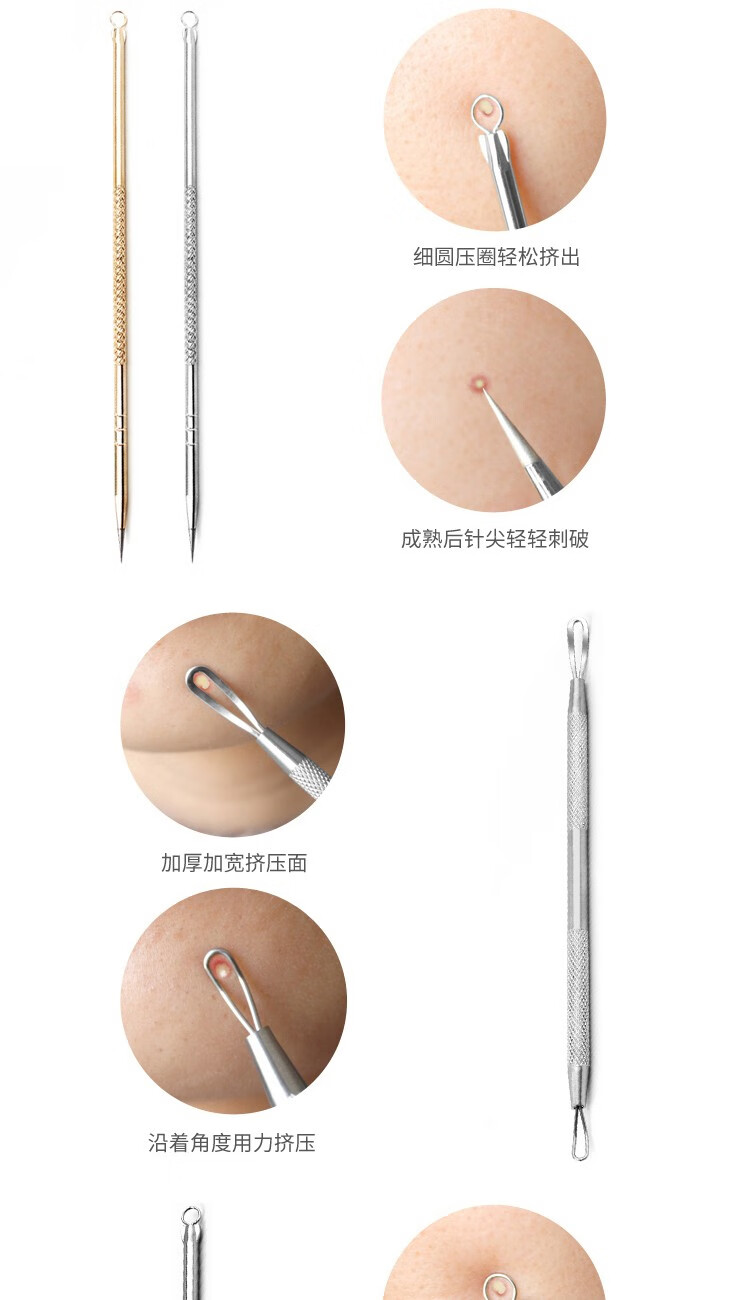 阿嚓热（ACARE） 不锈钢粉刺针挤痘痘排针三角头脸部美容细胞夹套装带多功能工具 1号双圈挤压棒+收纳盒
