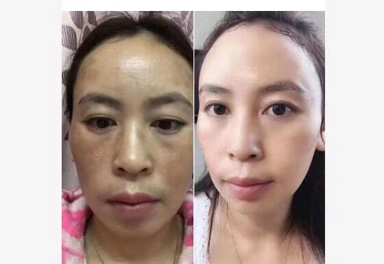 维怡美花开八度根草原液根果小白套装多肽修护冻干粉精华液水纯露小黑