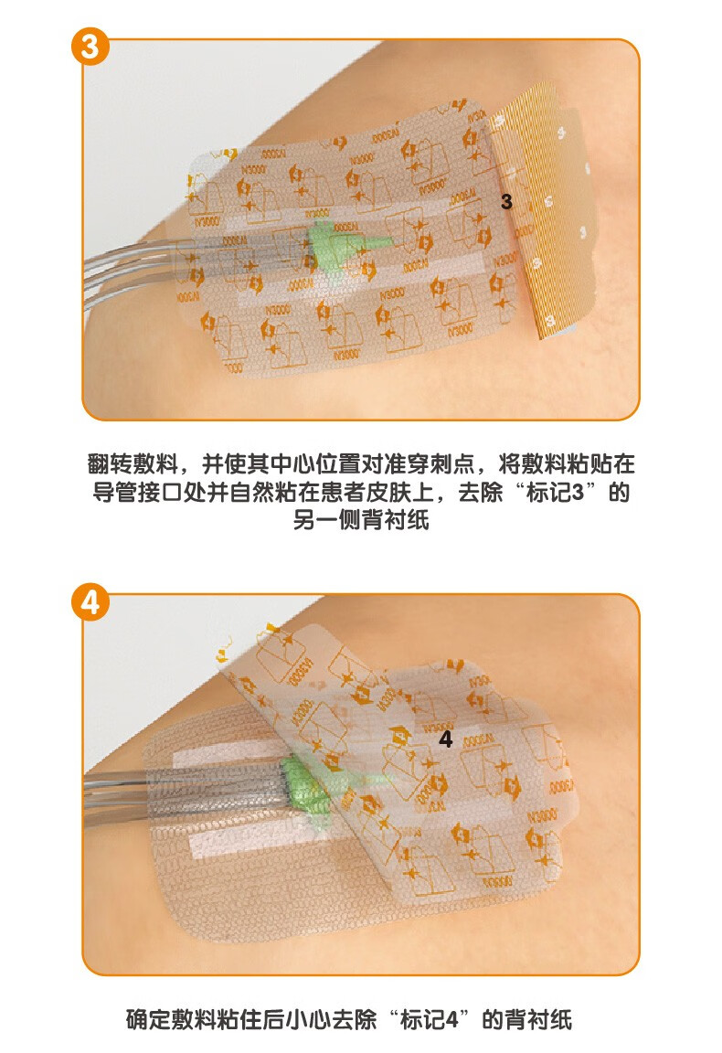 施乐辉 iv3000透明敷料picc静脉导管置管换药防水4008敷贴膜 5片(10*